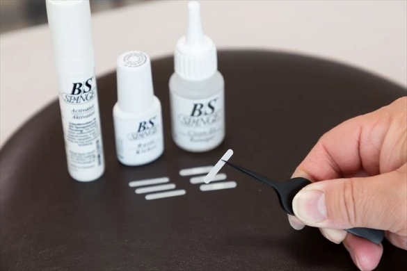 59.巻き爪矯正 ウィステリア